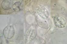 Phragmobasidien